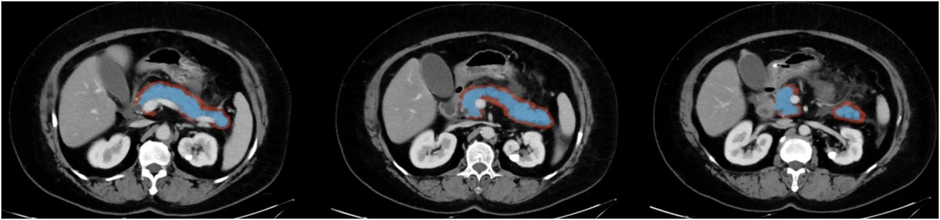 Fig1